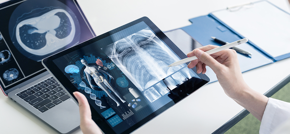 A cropped close up photo of a tablet computer showing x-ray and medical diagnostics.