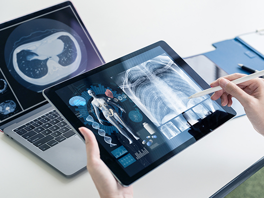 A cropped close up photo of a tablet computer showing x-ray and medical diagnostics.